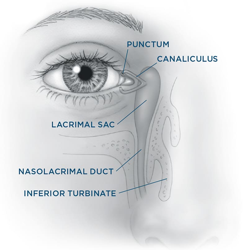 Adult Tearing diagram