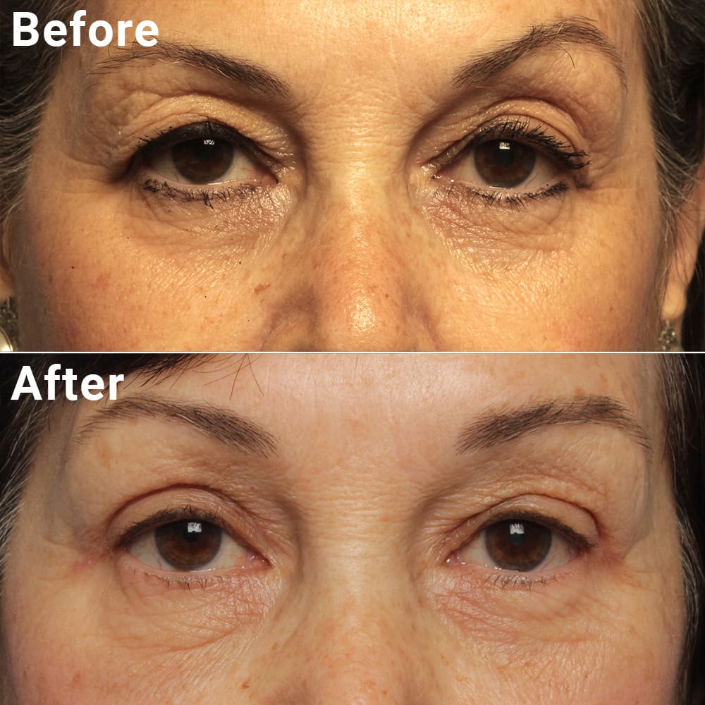 Comparative photos showing cosmetic procedure results